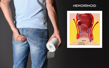 Image of Man with toilet paper suffering from hemorrhoid pain on black background, closeup. Illustration of unhealthy lower rectum