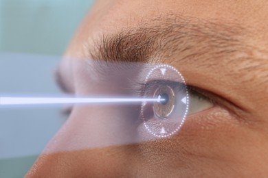 Closeup view of man and mark illustration on his eye. Vision correction surgery