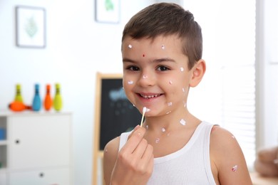 Woman applying cream onto skin of little boy with chickenpox at home