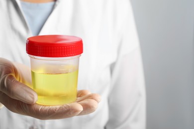 Doctor holding container with urine sample for analysis on grey background, closeup