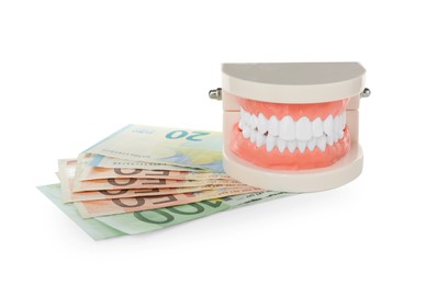 Educational dental typodont model and euro banknotes on white background. Expensive treatment