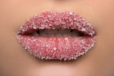 Photo of Woman with beautiful plump lips covered in sugar, closeup