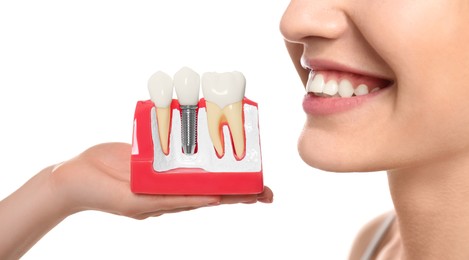 Young woman with beautiful smile and dentist holding educational model of dental implant on white background, closeup