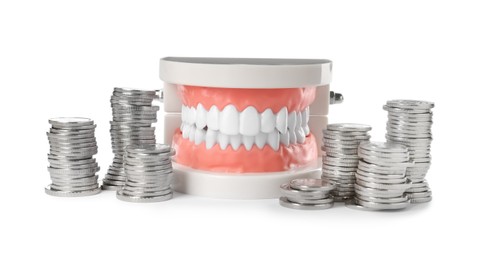 Educational dental typodont model and coins on white background. Expensive treatment