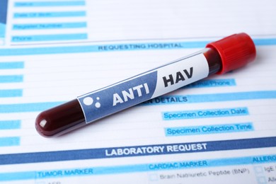 Tube with blood sample and label ANTI HAV on laboratory test form, closeup