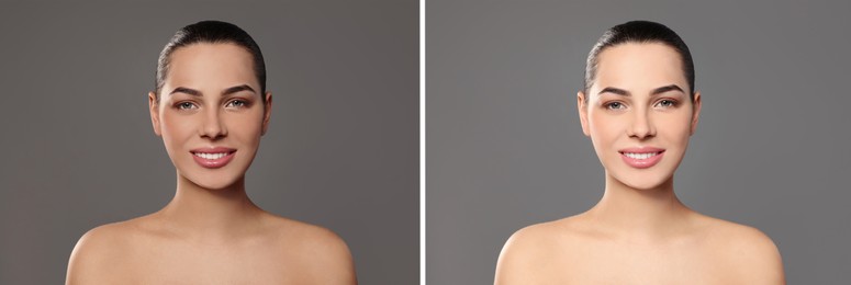 Collage with photos of beautiful young woman before and after indoor tanning on grey background. Banner design