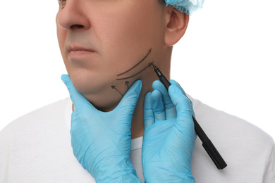 Photo of Surgeon with marker preparing man for operation on white background. Double chin removal