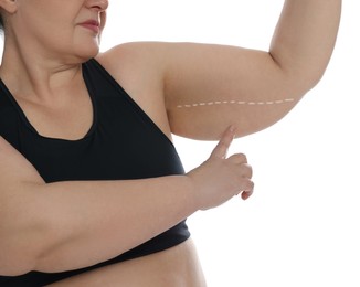 Obese woman with flabby arm on white background, closeup. Weight loss surgery