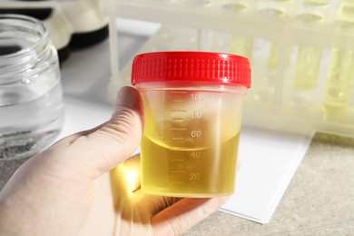Doctor holding container with urine sample for analysis at grey table, closeup