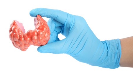Doctor holding plastic model of afflicted thyroid on white background, closeup