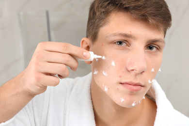 Photo of Teen guy with acne problem applying cream in bathroom