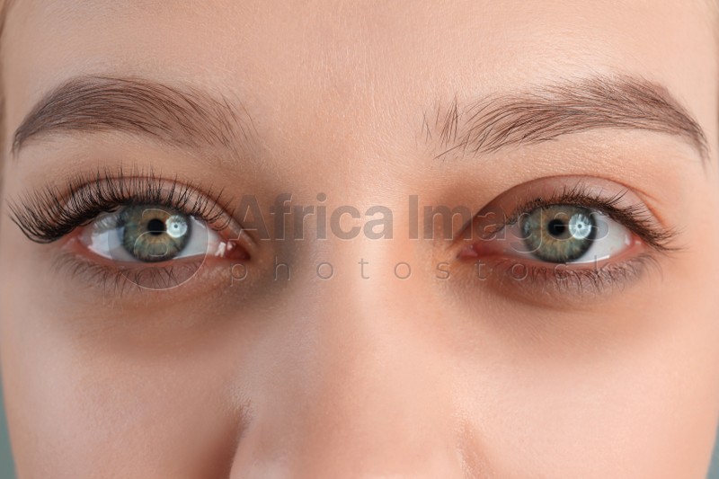 Tired young woman with dark circles under eyes, closeup