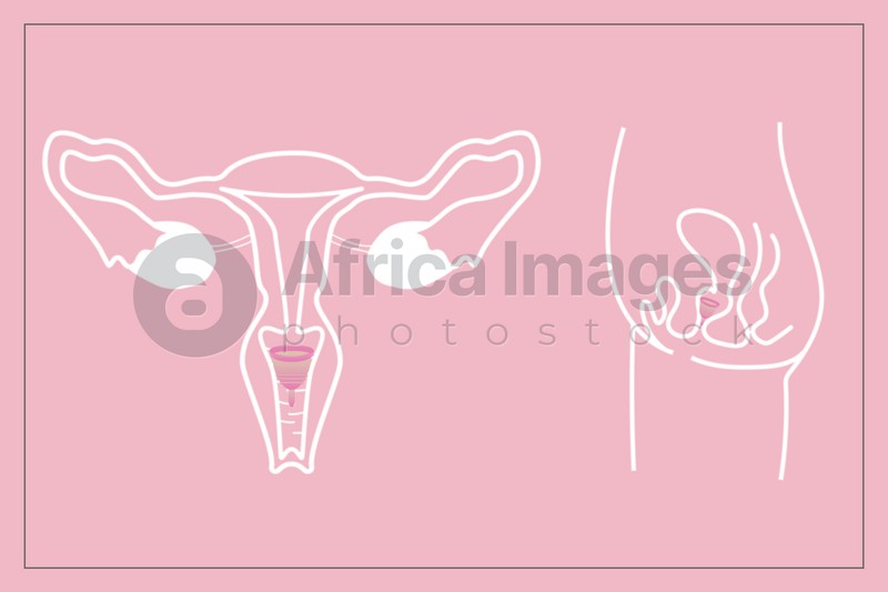 Instruction how to use menstrual cup during period. Female reproductive system on pink background, illustration