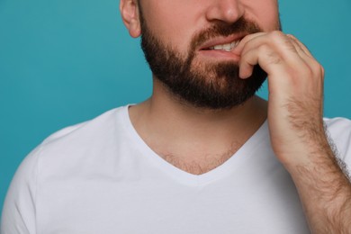 Photo of Man biting his nails on light blue background, closeup. Bad habit