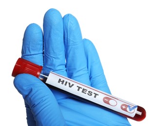 Scientist holding tube with blood sample and label HIV Test on white background, closeup