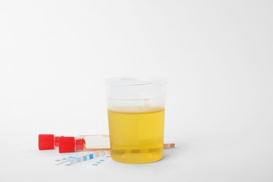 Laboratory ware with urine samples for analysis on white background