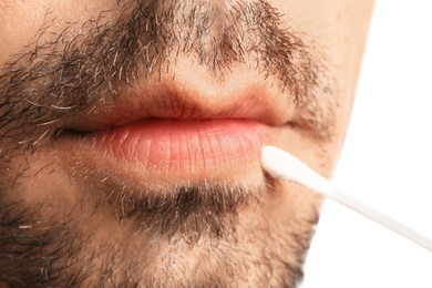 Young man with cold sore applying cream on lips against white background, closeup