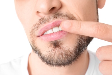 Man with cold sore touching lips on white background, closeup