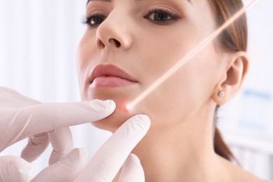 Image of Laser mole removal. Doctor checking patient's skin during procedure in clinic, closeup