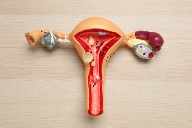 Anatomical model of uterus on wooden table, top view. Gynecology concept