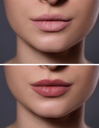 Collage with photos of woman with dry and moisturized lips, closeup