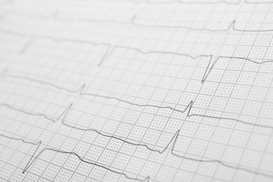 Photo of Cardiogram report as background, closeup view. Heart diagnosis