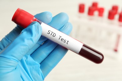 Scientist holding tube with blood sample and label STD Test on white background, closeup