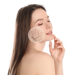 Young woman with facial dry skin problem on white background