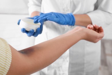 Doctor applying salve on woman's elbow with bruise in hospital, closeup