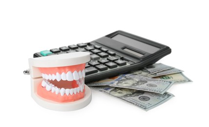 Educational dental typodont model, calculator and dollar banknotes on white background. Expensive treatment
