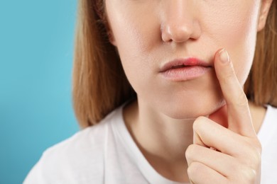 Woman suffering from herpes on light blue background, closeup