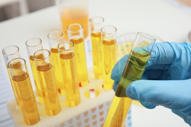 Doctor holding test tube with urine sample for analysis, closeup