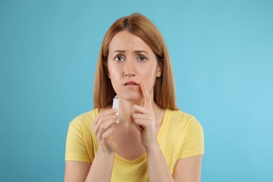 Upset woman with herpes applying cream on lips against light blue background