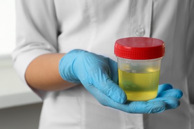Doctor holding container with urine sample for analysis, closeup