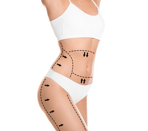 Slim young woman with marks on body for cosmetic surgery operation against white background, closeup