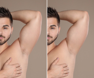 Collage of man showing armpit before and after epilation on light brown background
