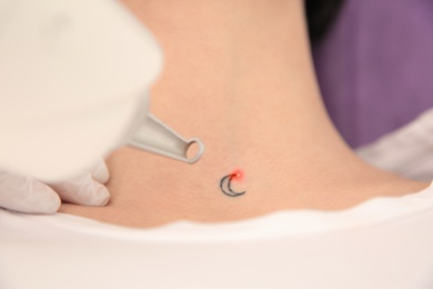 Young woman undergoing laser tattoo removal procedure in salon, above view