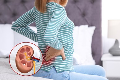 Image of Woman suffering from pain because of kidney stones disease at home