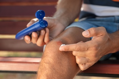 Man applying insect repellent cream on his leg outdoors, closeup
