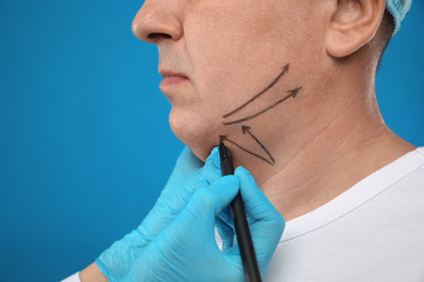 Photo of Surgeon with marker preparing man for operation on blue background. Double chin removal