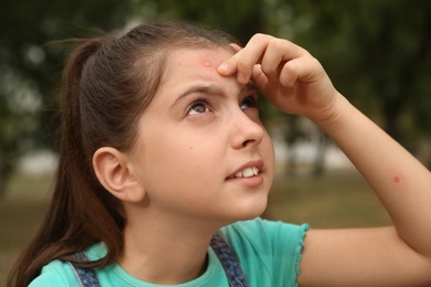 Girl scratching forehead with insect bite in park