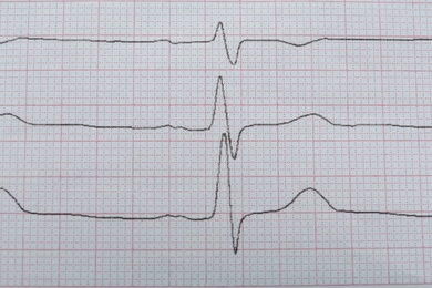 Photo of Cardiogram report as background, closeup. Heart diagnosis