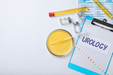 Flat lay composition with laboratory equipment and urine samples on light background. Urology concept