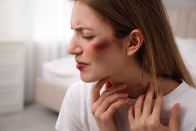 Woman with facial injuries in bedroom. Domestic violence victim