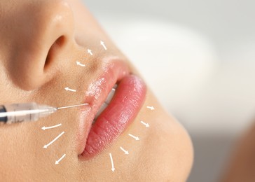Young woman getting lips injection on blurred background. Cosmetic surgery