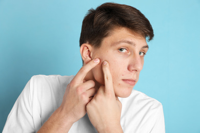 Teen guy with acne problem squeezing pimple on light blue background