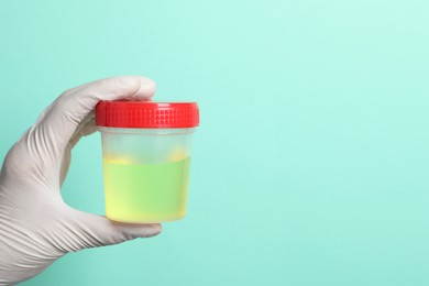 Doctor holding container with urine sample for analysis on turquoise background, closeup. Space for text