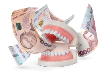 Model of oral cavity with teeth and hryvnia banknotes on white background. Concept of expensive dental procedures