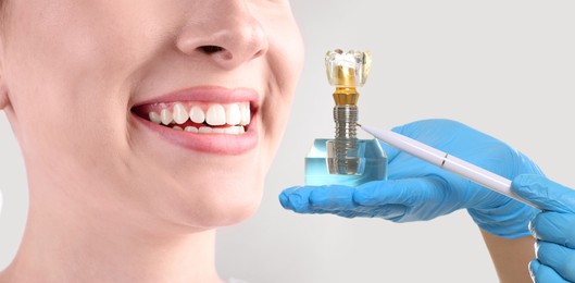 Young woman with beautiful smile and dentist holding educational model of dental implant on light background, closeup. Banner design