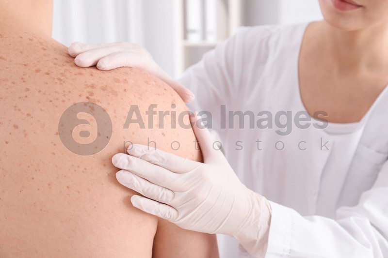 Doctor examining patient in clinic, closeup view. Visiting dermatologist